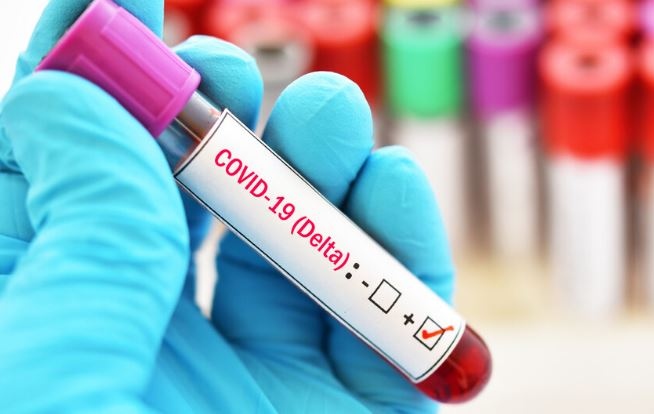 57 случая на Делта вариант на SARS CoV 2 известен като Индийски вариант